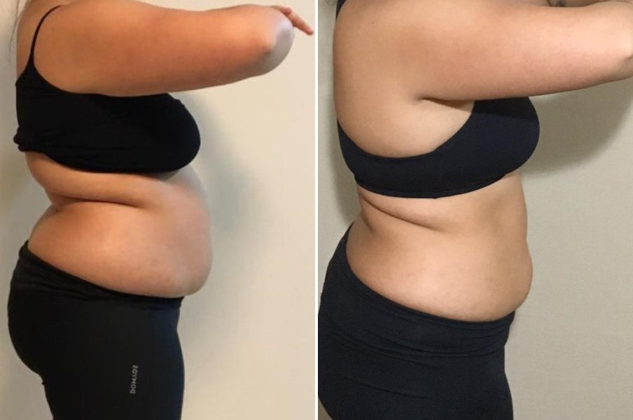 Participante de perfil, antes e depois do desafio
